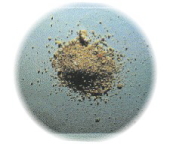 衝撃波治療によって砂状になった腎臓結石